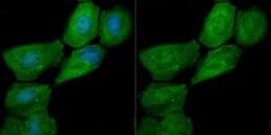 Galectin-7 Antibody (JB38-11), Novus Biologicals 100 &mu;l; Unconjugated:Antibodies,