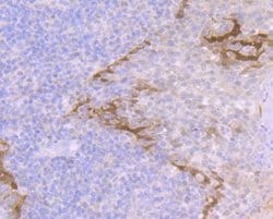 Galectin-7 Antibody (JB38-11), Novus Biologicals 100 &mu;l; Unconjugated:Antibodies,