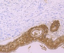 Galectin-7 Antibody (JB38-11), Novus Biologicals 100 &mu;l; Unconjugated:Antibodies,