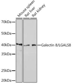 Galectin-8 Rabbit anti-Mouse, Rat, Clone: 7M9Q9, Novus Biologicals 100 &mu;g | Buy Online | Novus Biologicals | Fisher Scientific