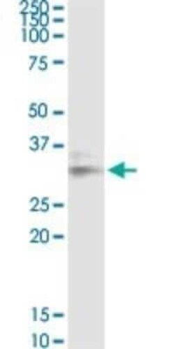 Galectin-8 Antibody (3E5), Novus Biologicals 0.1 mg, Unconjugated:Anticuerpos