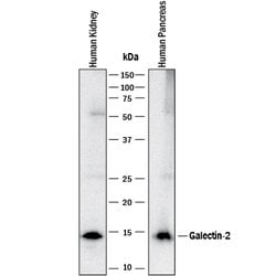 Human Galectin-2 Antibody, R D Systems 100 &mu;g; Unconjugated:Antibodies,
