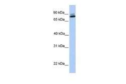 Gamma-Glutamyltransferase 7 Rabbit anti-Human, Polyclonal, Novus Biologicals