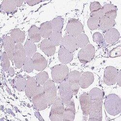 Gasdermin-A Antibody, Novus Biologicals 25 &mu;L, Unconjugated:Antibodies,