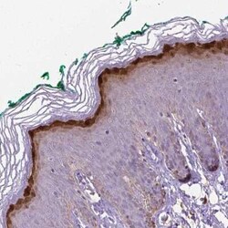 Gasdermin-A Antibody, Novus Biologicals 25 &mu;L, Unconjugated:Antibodies,