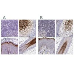 Gasdermin-A Antibody, Novus Biologicals 25 &mu;L, Unconjugated:Antibodies,