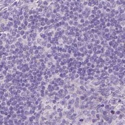 Gasdermin-A Antibody, Novus Biologicals 25 &mu;L, Unconjugated:Antibodies,