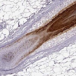 Gasdermin-A Antibody, Novus Biologicals 25 &mu;L, Unconjugated:Antibodies,