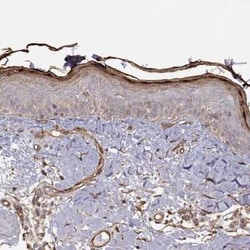 Gasdermin-A Antibody, Novus Biologicals:Antibodies:Primary Antibodies