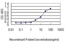 Gastrokine 1 Antibody (2E5), Novus Biologicals 0.1 mg; Unconjugated:Antibodies,