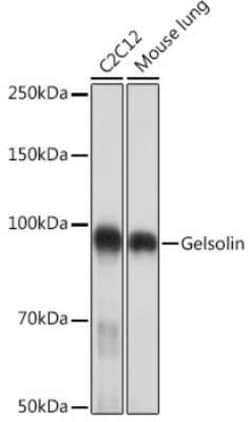 Gelsolin/GSN Rabbit anti-Human, Mouse, Clone: 5O10O1, Novus Biologicals 100 &mu;g | Buy Online | Bio-Techne | Fisher Scientific