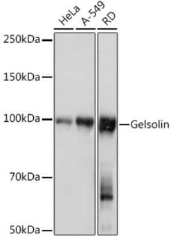 Gelsolin/GSN Rabbit anti-Human, Mouse, Clone: 5O10O1, Novus Biologicals 100 &mu;g | Buy Online | Bio-Techne | Fisher Scientific