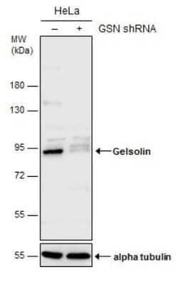 Gelsolin/GSN Antibody (GT1656), Novus Biologicals 100 &mu;g | Buy Online | Novus Biologicals | Fisher Scientific