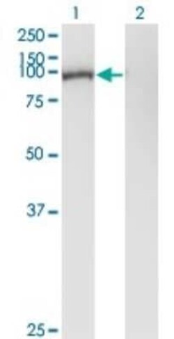 Gelsolin/GSN Antibody (3G5), Novus Biologicals 0.1 mg | Buy Online | Novus Biologicals | Fisher Scientific