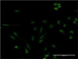 Gemin 4 Antibody (3E1), Novus Biologicals 0.1 mg | Buy Online | Novus Biologicals | Fisher Scientific
