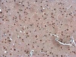 Gemin 5 Antibody, Novus Biologicals 100 &mu;g | Buy Online | Novus Biologicals | Fisher Scientific