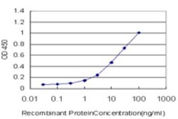 Gemin 7 Antibody (2E2), Novus Biologicals 0.1 mg | Buy Online | Novus Biologicals | Fisher Scientific