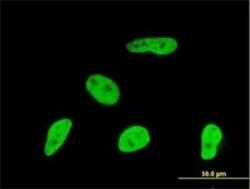Geminin Antibody (1A8), Novus Biologicals 0.1 mg | Buy Online | Novus Biologicals | Fisher Scientific