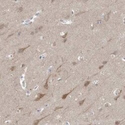 Gephyrin/GPHN Antibody, Novus Biologicals 0.1 mL | Buy Online | Novus Biologicals | Fisher Scientific