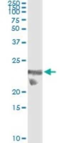 GilZ Antibody (3A5), Novus Biologicals 0.1 mg | Buy Online | Novus Biologicals | Fisher Scientific