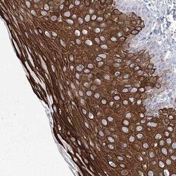 Girdin Antibody, Novus Biologicals 0.1 mL; Unconjugated:Antibodies, Polyclonal