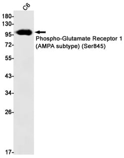 GluR1, p Ser845 Antibody (S03-7G4) - AMPA Subtype, Novus Biologicals 100 &mu;g | Buy Online | Novus Biologicals | Fisher Scientific