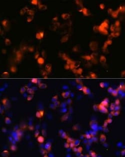 GluR2 Rabbit anti-Human, Mouse, Rat, Clone: 9R1X2, Novus Biologicals 20