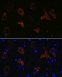 GluR2 Rabbit anti-Human, Mouse, Rat, Clone: 9R1X2, Novus Biologicals 20