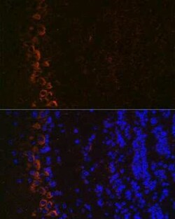 GluR2 Rabbit anti-Human, Mouse, Rat, Clone: 9R1X2, Novus Biologicals 20