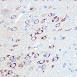 GluR2 Rabbit anti-Human, Mouse, Rat, Clone: 9R1X2, Novus Biologicals 20