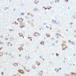GluR2 Rabbit anti-Human, Mouse, Rat, Clone: 9R1X2, Novus Biologicals 20
