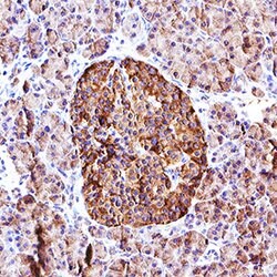 Human Glucagon R/GCGR Antibody, R D Systems 25 ug; Unconjugated:Antibodies,