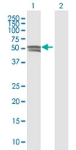 Glucosaminyl (N-acetyl) Transferase 1/GCNT1 Antibody, Novus Biologicals 50 &mu;g | Buy Online | Novus Biologicals | Fisher Scientific