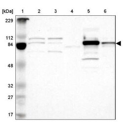 Glucose 1-dehydrogenase Antibody, Novus Biologicals 0.1 mL | Buy Online | Novus Biologicals | Fisher Scientific