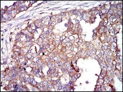 Glucose 6 Phosphate Dehydrogenase Antibody (2H7) - Azide and BSA Free,