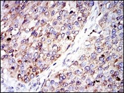 Glucose 6 Phosphate Dehydrogenase Antibody (2H7) - Azide and BSA Free,