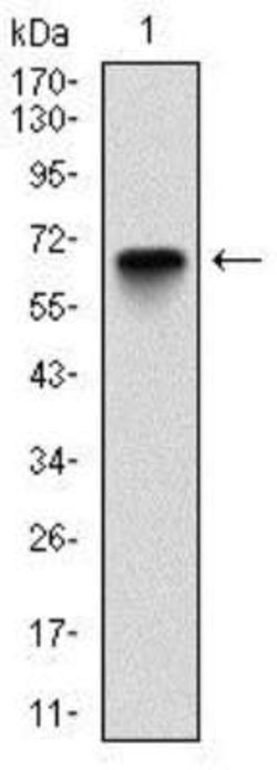 Glucose 6 Phosphate Dehydrogenase Antibody (2H7) - Azide and BSA Free,