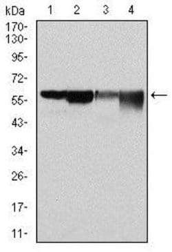 Glucose 6 Phosphate Dehydrogenase Antibody (2H7) - Azide and BSA Free,