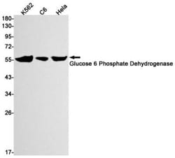 Glucose 6 Phosphate Dehydrogenase Rabbit anti-Human, Mouse, Rat, Clone: