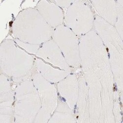 Glucose 6 Phosphate Dehydrogenase Antibody, Novus Biologicals 0.1 mL | Buy Online | Novus Biologicals | Fisher Scientific