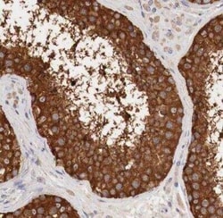 Glucose 6 Phosphate Dehydrogenase Antibody, Novus Biologicals 0.1 mL | Buy Online | Novus Biologicals | Fisher Scientific