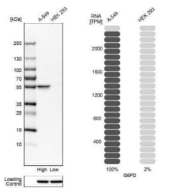Glucose 6 Phosphate Dehydrogenase Antibody, Novus Biologicals 0.1 mL | Buy Online | Novus Biologicals | Fisher Scientific