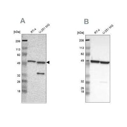 Glucose 6 Phosphate Dehydrogenase Antibody, Novus Biologicals 0.1 mL | Buy Online | Novus Biologicals | Fisher Scientific