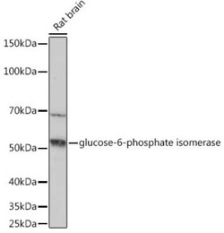 Glucose 6 phosphate isomerase Rabbit anti-Human, Rat, Clone: 2Y8R0, Novus