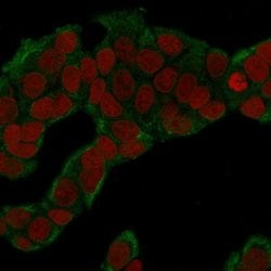 Glucose 6 phosphate isomerase, Mouse anti-Human, Clone: CPTC-GPI-1, Novus