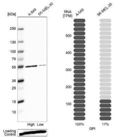 Glucose 6 phosphate isomerase Antibody, Novus Biologicals:Antibodies:Primary