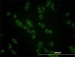 Glucosylceramidase/GBA Antibody (2E2), Novus Biologicals 0.1 mg; Unconjugated:Antibodies,