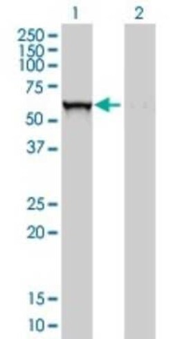 Glucosylceramidase/GBA Antibody (2E2), Novus Biologicals 0.1 mg; Unconjugated:Antibodies,