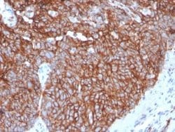 Glut1 Rabbit anti-Human, Clone: GLUT1/3132R, Novus Biologicals:Antibodies:Primary