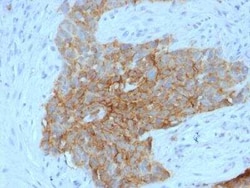 Glut1 Antibody (GLUT1/2475), Novus Biologicals:Antibodies:Primary Antibodies